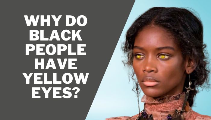 Why Do Black People Have Yellow Eyes?