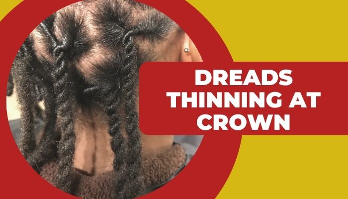 Dreads Thinning at Crown 10 Common Causes and Solutions!