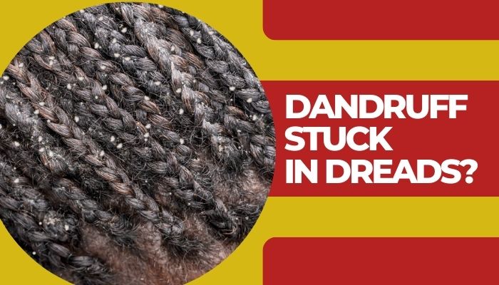 How to Get White Stuff Out of Dreads