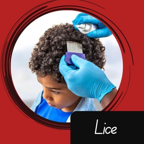 Why Dont Black People Get Lice 1