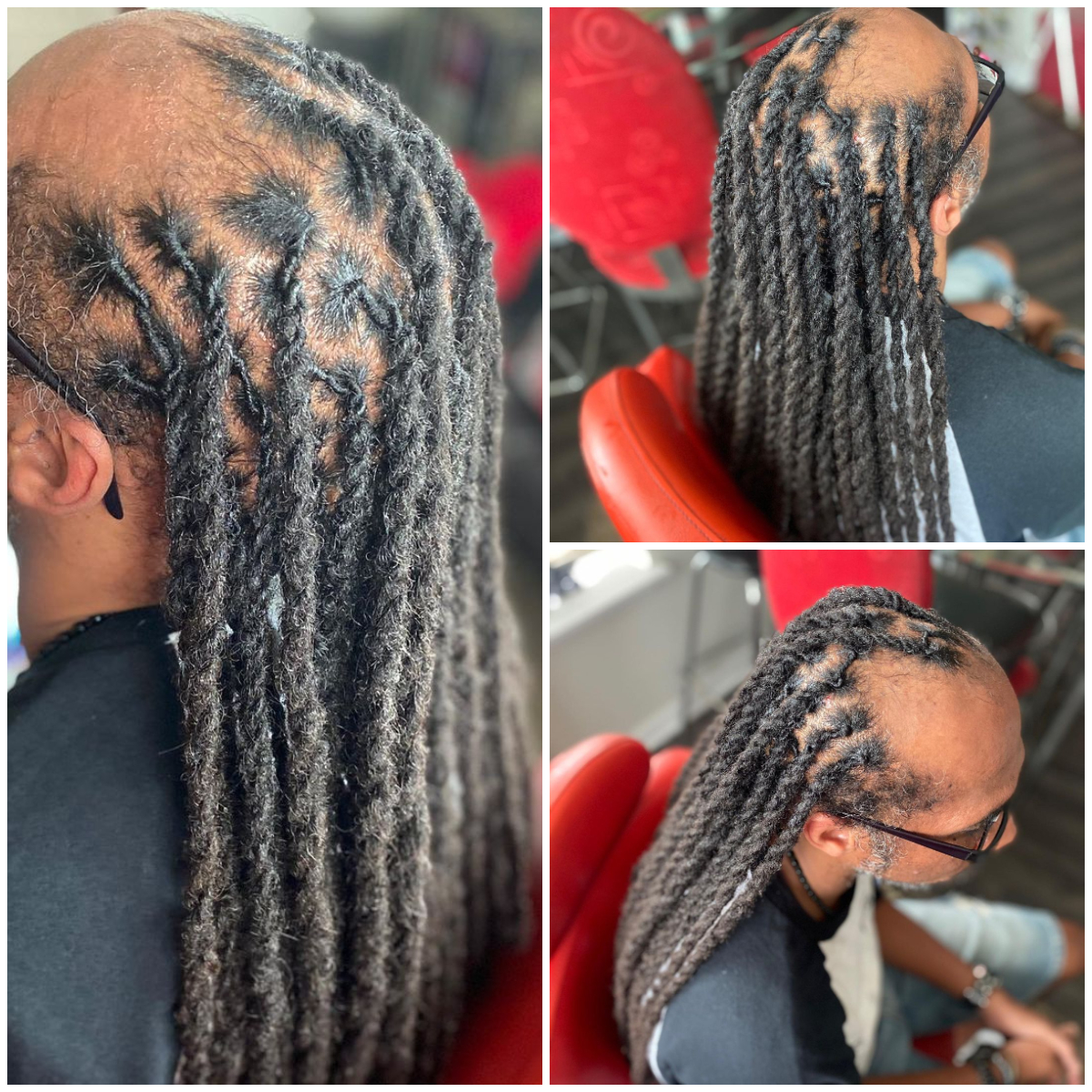 Front Bald Long Two Strand Twist
